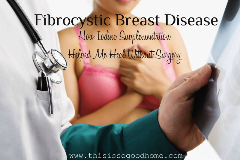 Fibrocystic Breast Disease – How Iodine Supplementation Helped Me Heal Without Surgery